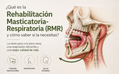 ¿Qué es la Rehabilitación Masticatoria-Respiratoria (RMR) y cómo saber si la necesitas?